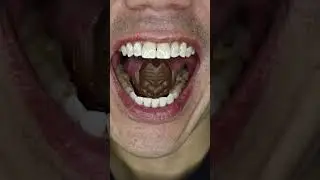 ASMR | Ultraman Alien Baltan Chocolate Bite #DoctorTristanPeh #ASMR #Ultraman #AlienBaltan #Japan