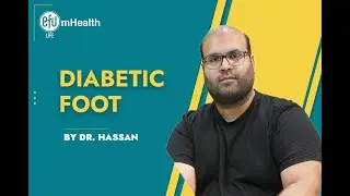 Diabetic Foot: Prevention and Care | Health and Happiness  | 2023
