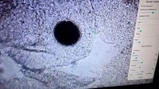 Elite Koi Fish Health - Koi Parasite Whitespot identified using a Microscope to identify parasites