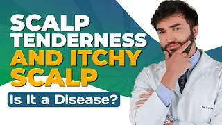 Scalp Tenderness  and ITCHy Scalp   Is it a disease