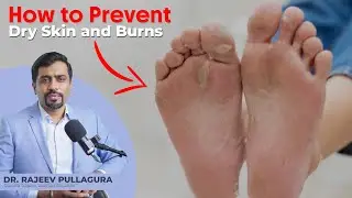 Diabetic Feet: How to Prevent Dry Skin and Burns