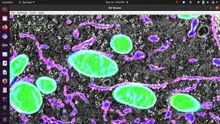 Fiji's N5 plugins access OpenOrganelle data on AWS S3