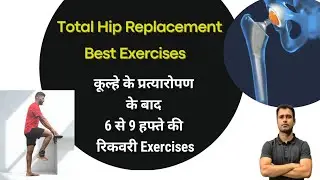 Total Hip Replacement Exercises In Hindi | THR 6-9 weeks Exercises | Exercises after Hip Replacement