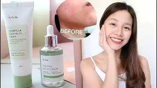 iUNIK Centella Calming Gel Cream + iUNIK Tea Tree Relief Serum  Review | iUNIK honest review ph