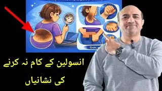 Признаки и симптомы, указывающие на инсулинорезистентность | Остерегайтесь этих признаков инсулин...