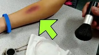 How to create a fake bruise