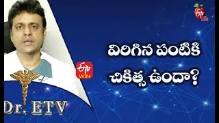 Broken Tooth - Treatment | విరిగిన పంటికి చికిత్స ఉందా | Dr.ETV | 13th October 2021 | ETV Life