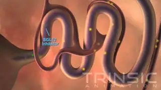 Diabetic Kidney Medical Animation