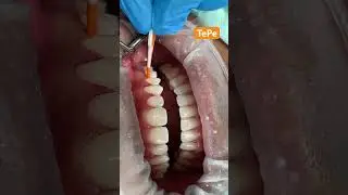 How to TePe #flossing #gums #healthy #dental