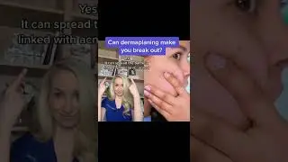 Can Dermaplaning Make You Breakout?