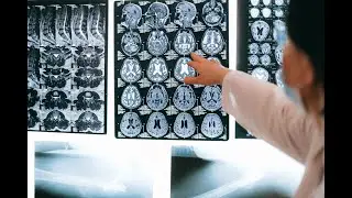 Dysembryoplastic Neuroepithelial Tumour: The Benign Brain Tumour That Disrupts Young Lives