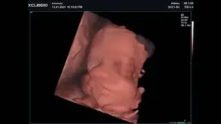 28 Weken Echo, 3D Foto's, Drinken en Tong Uitsteken