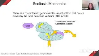 1st Pediatric Spine Academy India Webinar - Physical Therapy in AIS