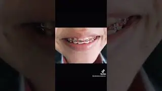 Caso cl&iacute;nico en proceso 007