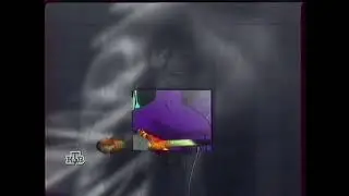 НТВ 1999 / Заставка 