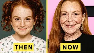 20 Child Stars Who Completely RUINED Their Faces | 2025 Update