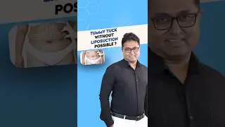 Why Liposuction should be done for the best TUMMY TUCK results? Dr. Karthik Ram