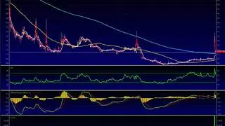 SINT  Stock Analysis / SINTX Technologies  Stock