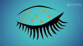 Die L&ouml;sung bei trockenen Augen