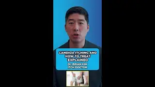 Candida Itching and How To Treat It