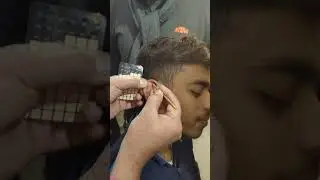 Auricular therapy training in shahdara Delhi #utubeshort #auriculartherapy