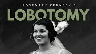 Почему Розмари Кеннеди сделала лоботомию?