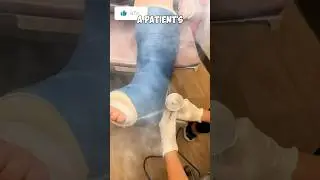 Как снять гипс!!🤯 Это не медицинская консультация #шорты