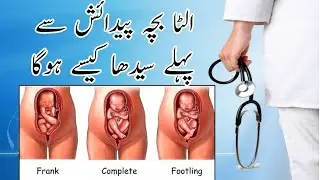 How to turn breech baby into head down | Ulta bacha sidha @drmrssaeedkarim