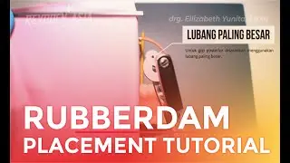 RUBBERDAM MAXI DAM PLUS PLACEMENT TUTORIAL BY REVODEN WITH DRG. ELLIZABETH YUNITA SP.KG
