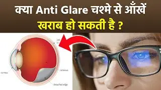 Anti Glare Glass Side Effects: क्या एंटी-ग्लेयर चश्मा लगाने से ऑंखें खराब हो सकती है...|Boldsky