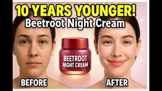 Look 10 Years Younger Naturally!😱😱 Beetroot Night Cream Results