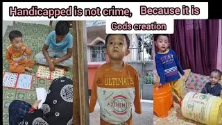 Handicapped is not crime Because it is God's creation & what a tricks to learn colour name #shorts