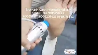 Biotronix Shockwave Therapy Clinical Model