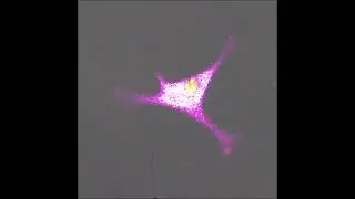 T CELL KILLING A CANCER CELL #cancer #cancertreatment