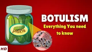 Botulism &ndash; Causes, Types, Signs and Symptoms, Diagnosis & Treatment