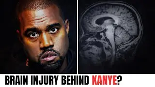 Kanye West Says Brain Damage Played a Role in His Antisemitic Meltdown