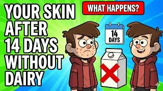 YOUR SKIN AFTER 14 DAYS OF NO DAIRY. (The Truth Revealed)