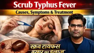 Scrub Typhus Cause Symptoms and Treatment Explained | स्क्रब टाइफस बुखार क्या है?