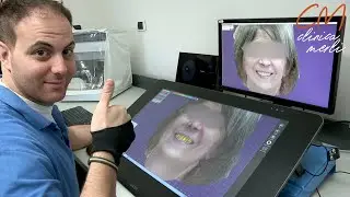 CAD Design con scansione 3D facciale - Clinica Merli