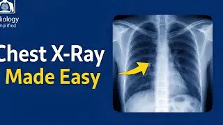 How to Read Chest X-Ray for Beginners | Step by Step
