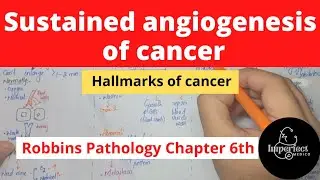 Sustained Angiogenesis of  Cancer |Hallmarks of Cancer, #neoplasia #pathology #robbins #cancer