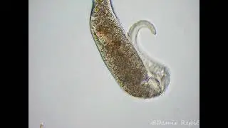 Dileptus