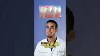 Limpieza y CUIDADOS del PUENTE DENTAL - Alarga su vida con estos consejos