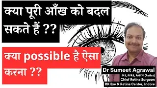 Is Full Eye Transplant possible ? जानिये latest developments.