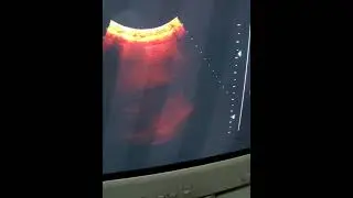 جنين ساجد في بطن أمه سبحان الله