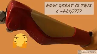 Amputee- Microprocessing knee&rdquo; Preventing me from piling into the ground&rdquo;