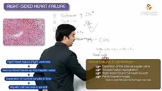 Right-sided heart failure - Part 2 (Clinical features, Investigations) : Usmle step 1