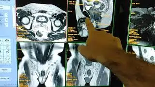 Male Pelvis MRI Anatomy.