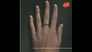 Opulent Rings