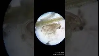 Daphnia:Tiny Aquatic Ballet.#TinyDancers #UnderwaterLife#ScienceInAction#MicroscopicWorld#WaterLife